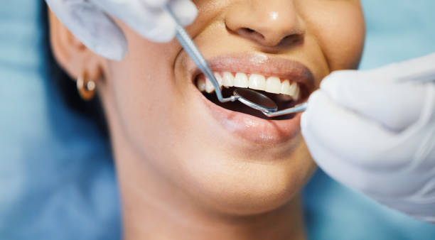 Best Knocked-Out Tooth (Avulsed Tooth) Treatment in , CO