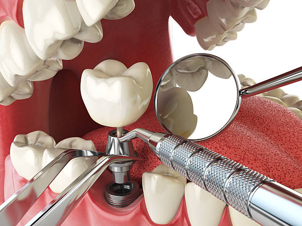 Best Emergency Treatment for Jaw Pain or Injury in , CO